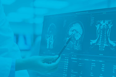 Atendimento ao AVC (Stroke) - HCI